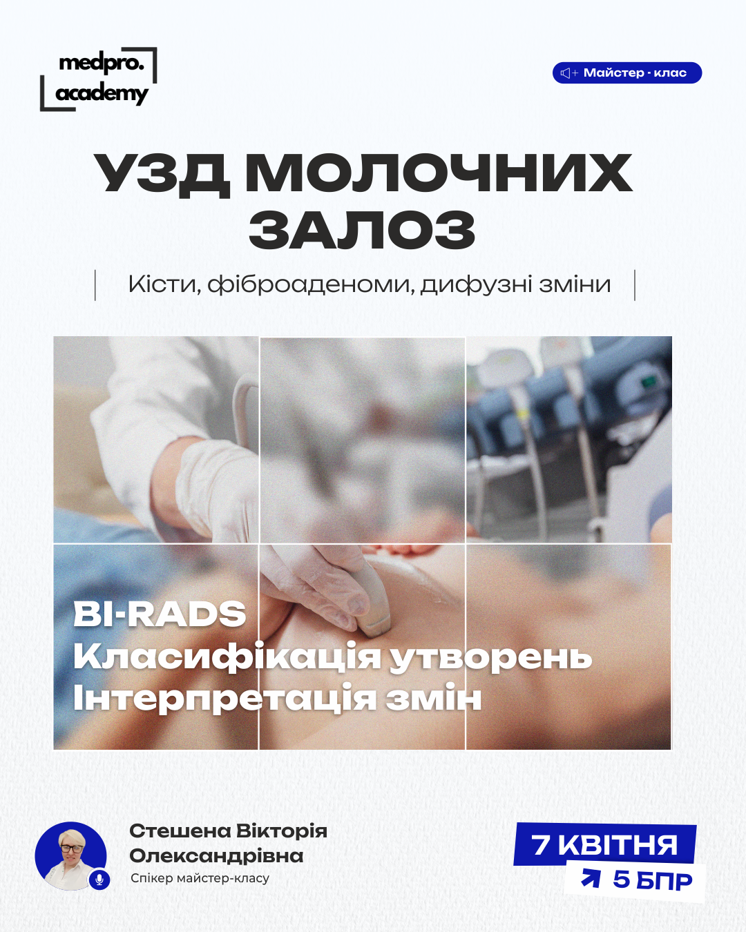 3УЗД молочних залоз кісти, фіброаденоми, дифузні зміни